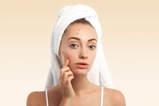 Makeup Tutorial For Acne Prone Skin