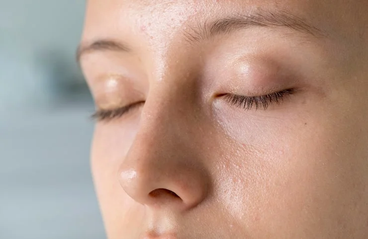 Why Oily Skin Still Needs Water